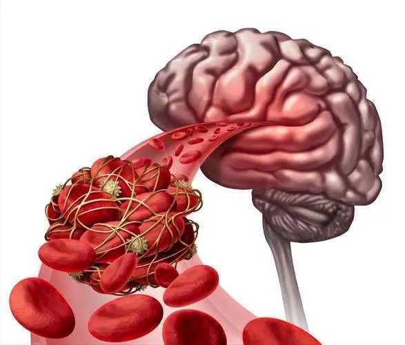 Eptifibatide uses CAS 188627-80-7 | Shaanxi BLOOM Tech Co., Ltd Eptifibatide uses CAS 188627-80-7 | Shaanxi BLOOM Tech Co., Ltd