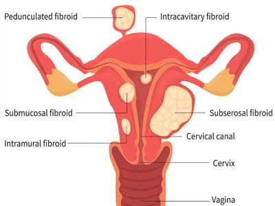 Carbetocin For sale | Shaanxi BLOOM Tech Co., Ltd Carbetocin For sale | Shaanxi BLOOM Tech Co., Ltd